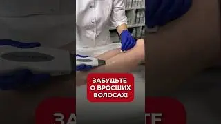 ВРОСШИЕ ВОЛОСЫ: что делать? 3 шага которые избавят вас от этой проблемы #аюна #вросшие #уход #ноги