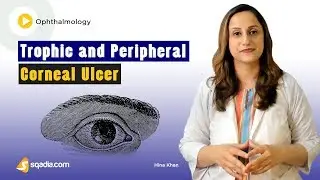 Trophic and Peripheral Corneal Ulcer | Medical Ophthalmology Lectures | V-Learning