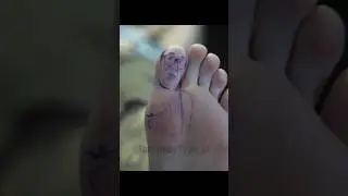 Danny Devi-Toe Trash Man Tattoo