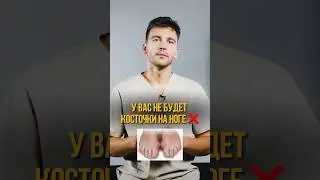 ПРОФИЛАКТИКА КОСТОЧКИ НА НОГЕ👩🏽‍⚕️