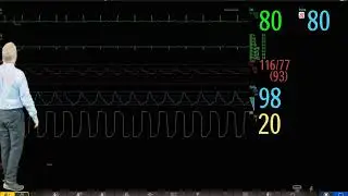 Philips IntelliVue Patient Monitoring - #1 - Introduction to Basic Operation