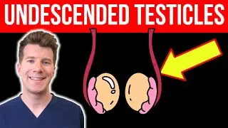 Doctor explains UNDESCENDED TESTICLES | Causes, symptoms, treatment