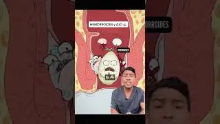 EL AJO NO ES UN REMEDIO PARA LA HEMORROIDES 🩸👌| DR. RAWDY
