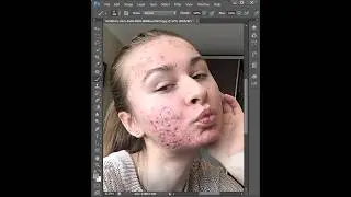 Skin retouching in photoshop 