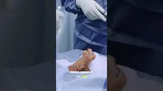 Left First Toe Amputation (Ray, Cadaver) #howto #surgery #medicine #doctor #hospital #learn #watch