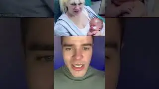 Мальчик Родился Без Мозга и Вы Не Поверите Что С Ним Сделали… 