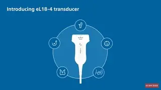 Philips eL18-4 ultra-broadband transducer value proposition