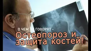 О ЧЕМ НЕ ГОВОРЯТ – Остеопороз и защита костей! Остеопороз это не от возраста, а от образа жизни!