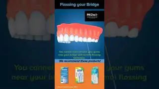 Cleaning Dental Bridges