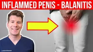 Penis pain and inflammation? Balanitis Explained: Symptoms, Causes, and Treatment Options