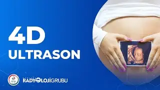 4 Boyutlu Ultrason Nedir? I 4D Ultrason I Radyoloji Grubu