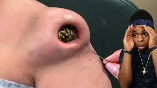 something weird got stuck there..