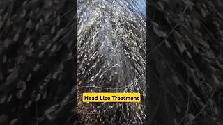 Get rid of Head LICE and EGGS! 