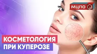 КУПЕРОЗ Как бороться с сосудами на лице. Курс косметологов