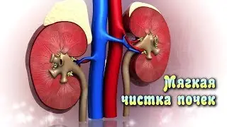 ОЧИЩЕНИЕ ПОЧЕК от песка и камней