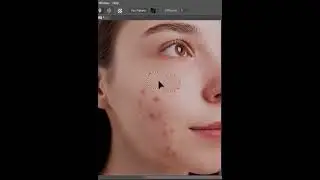 How to remove pimples easily in photoshop 2022 || Only for beginners