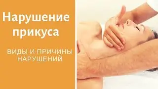 Нарушение прикуса. Исправление неправильного прикуса. Виды прикусов и причины