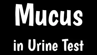 Mucus in Urine Test | Causes & Symptoms Of Mucus In Urine | Microscopic Urine Analysis |