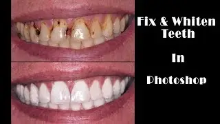 Whiten and Fix Teeth In Photoshop | Best Way to Whiten Teeth in Photoshop | Use of selective Color