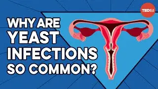 What causes yeast infections, and how do you get rid of them? - Liesbeth Demuyser