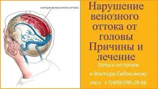 Нарушение венозного оттока головного мозга по позвоночным венам  Причины нарушения венозного оттока