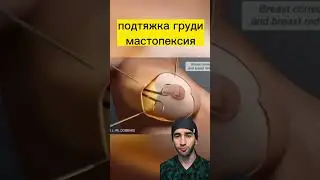 грудь опустилась что делать?