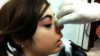 Piercing Naso(Ago Cannula)