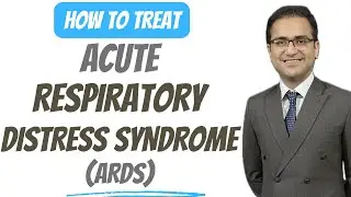 Acute Respirtory Distress Syndrome (ARDS) Treatment, Pathophysiology, Medicine Lecture USMLE NeetPg