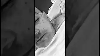 Андрей Щадило в Реанимации.
