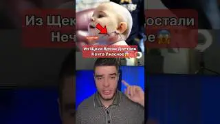 В Щеке Девочки Было Нечто Ужасное😱
