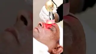 Get rid of Wrinkles | Anti-ageing Treatment | Facial rejuvenation Treatment  