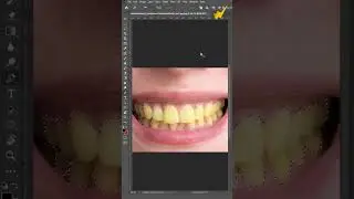 How to remove yellow color from teeth easy with Adobe Photoshop by pen tool 