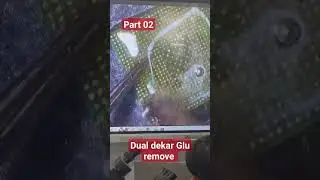 dual dekar Glu remove #shortfeed #unlocker #shortsviral #mobile #unlock #unlockphone #viralvideos