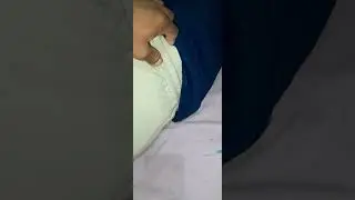 Intramuscular Injection Buttock| Injection video very painful| Intramuscular Injection demonstration