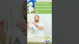 Лечение разной длины ног на одном приёме врача остеопата. часть 1