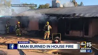 Man burned in Phoenix house fire