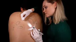 ASMR | Dermatologist does a BACK INSPECTION [TINGLY FRIDAY]