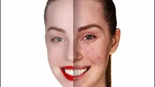 How to remove acne & pimples from face in photoshop | Remove Blemishes & Scars