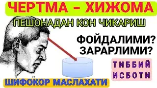 ЧЕРТМА ХИЖОМА ПЕШОНАДАН КОН ЧИКАРИШ ХАВФЛИМИ? | CHERTMA XIJOMA PESHONADAN QON CHIQARISH XAVFLIMI?