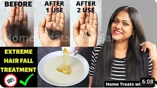 STOP Hairfall 👉 Best Effective Hairfall Control Hair Pack | Extreme Hair Fall Treatment | 💯 Results