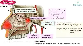 Epistaxis  👃🩸 : ENT Lectures