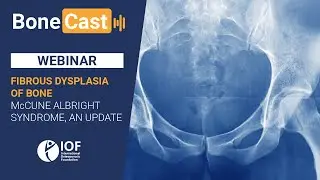 Fibrous dysplasia of bone McCune Albright syndrome, an update