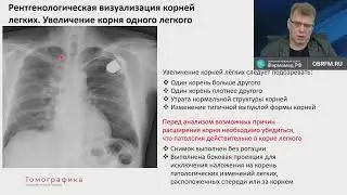 Рентгенолог Гаврилов П.В.: Лучевая диагностика: Увеличение внутригрудных лимфоузлов