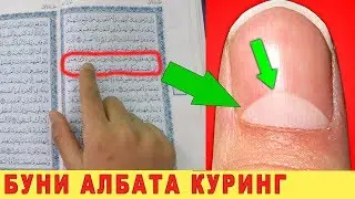 СИЗ БУ НАРСАНИ БИЛГАНМИДИЗ?
