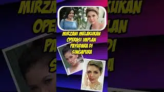 5 Artis Indonesia yang Pernah Melakukan Operasi Implan Payudara 