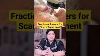 Laser Treatments for Face | Pimples and 