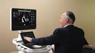 Philips Cardiovascular Ultrasound: AutoStrain RV