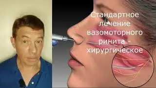 Вазомоторный ринит: почему операция не всегда эффективна