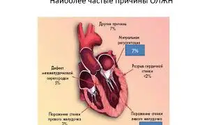 Кардиогенный шок - Вотяков А.Л.
