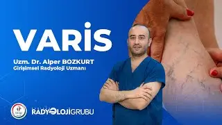 Varis Nedir, Ameliyatsız Varis Tedavisi Nasıl Yapılmaktadır? - Radyoloji Grubu